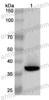 Валидация AntibodySystem PHB15701