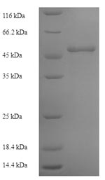 SDS-PAGE