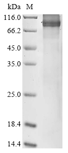 SDS-PAGE
