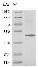 SDS-PAGE