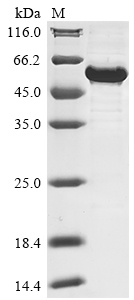 SDS-PAGE