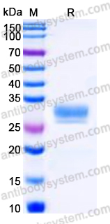 EHN97401, SDS-PAGE