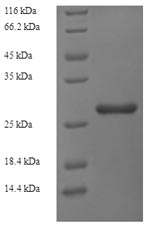 SDS-PAGE