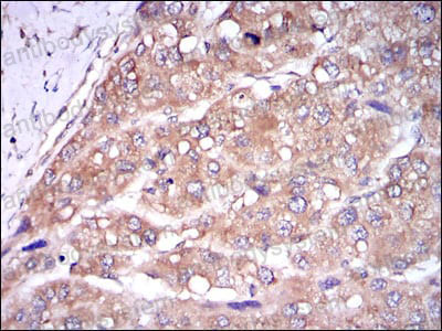 Валидация AntibodySystem RHG90203