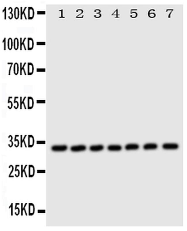 Валидация AssayVector ARM1895(2608)