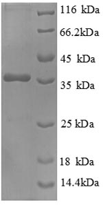 SDS-PAGE