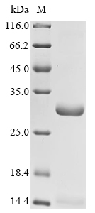 SDS-PAGE