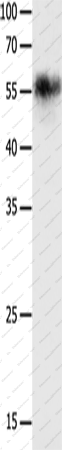 Вестерн-блоттинг, CHRNA3, клетки HeLa