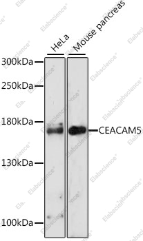 Вестерн-блоттинг, CEACAM5, различные клеточные линии