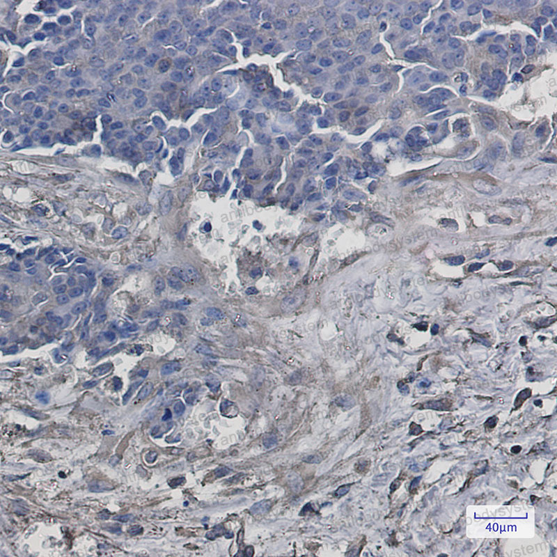 Валидация AntibodySystem RHN87501