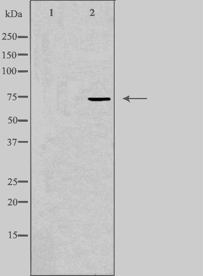 Валидация AssayVector ARM2544(4580)