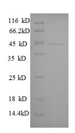 SDS-PAGE