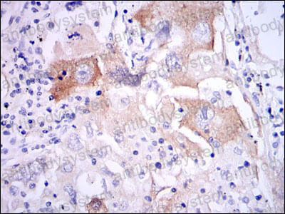 Валидация AntibodySystem RHB95601