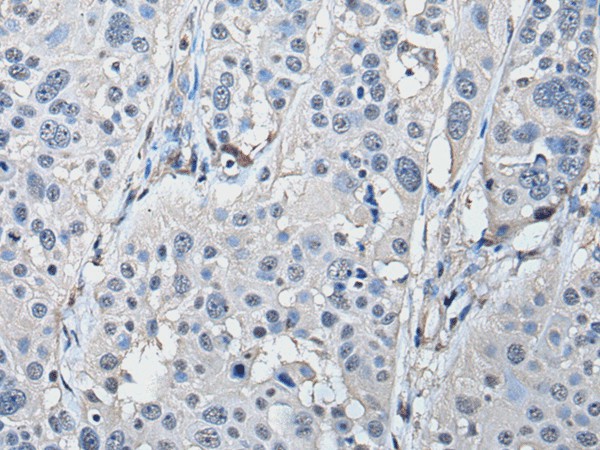 Валидация Elabscience E-AB-52196