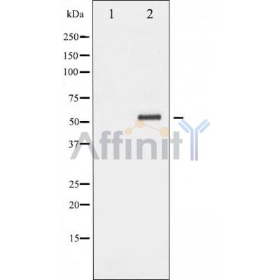 Валидация Affinity DF5000 - 16861