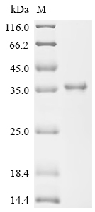 SDS-PAGE