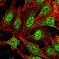 Валидация IF - AntibodySystem RHK50101