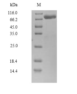 SDS-PAGE