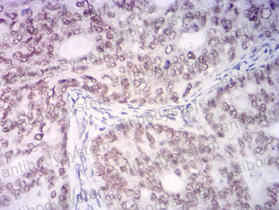 Валидация AntibodySystem RHA88905 (228)