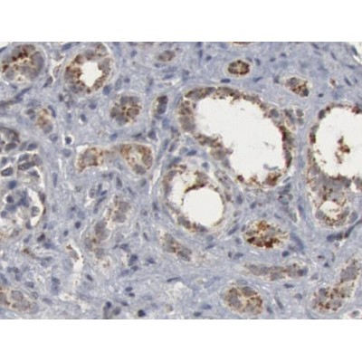 Валидация Affinity AF5244 - 2737