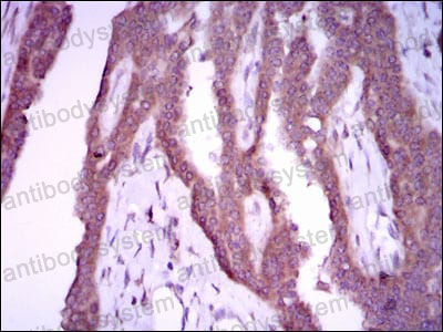 Валидация AntibodySystem RHE08001