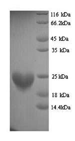 SDS-PAGE