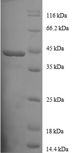 SDS-PAGE