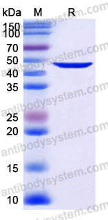 YHD37303, SDS-PAGE