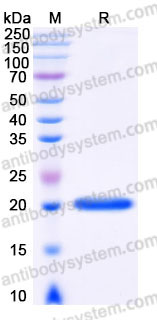 EHC11801, SDS-PAGE