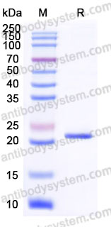 AHN01802, SDS-PAGE