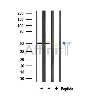 Валидация Affinity DF6548 - 17984