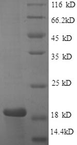 SDS-PAGE