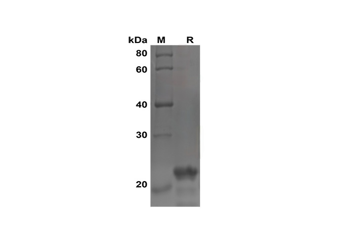 PDEH101144, электрофорез в ПААГ с ДСН
