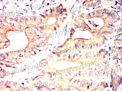 Валидация AntibodySystem RHJ43503 (3403)