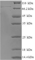 SDS-PAGE