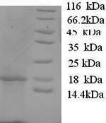 SDS-PAGE