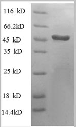 SDS-PAGE