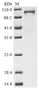 SDS-PAGE