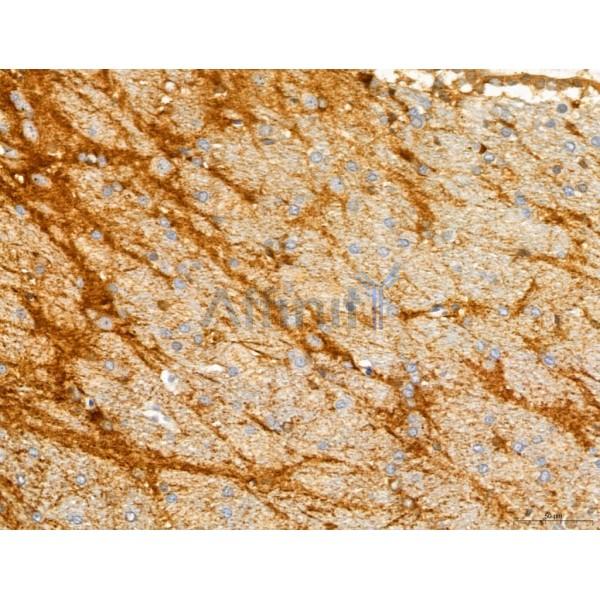 Валидация Affinity DF12134 - 6300