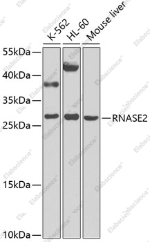 Вестерн-блоттинг, RNASE2, различные клеточные линии