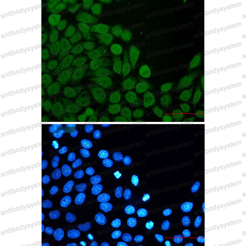 Валидация IF - AntibodySystem RHE23301