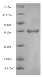 SDS-PAGE