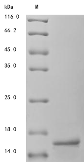 SDS-PAGE