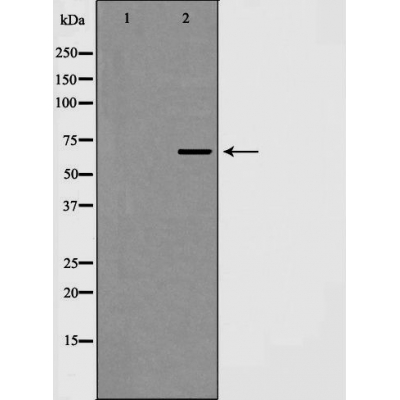 Валидация Affinity AF5408 - 3055