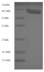 SDS-PAGE