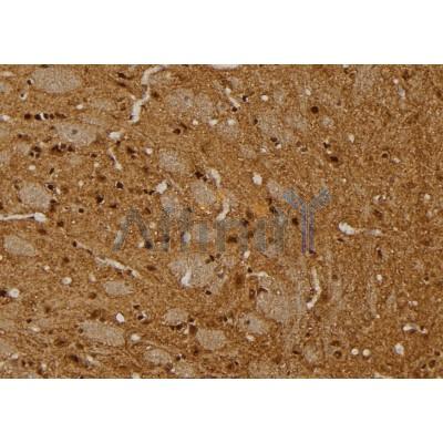 Валидация Affinity AF6107 - 3317