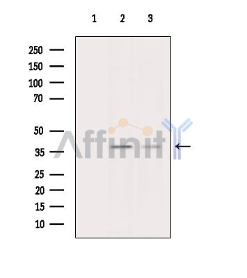 Валидация Affinity DF10151 - 5676