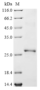 SDS-PAGE