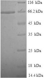 SDS-PAGE