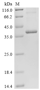 SDS-PAGE